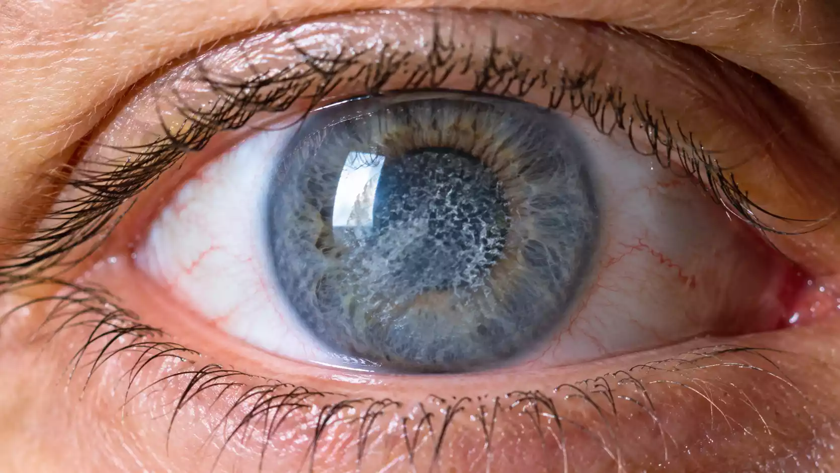 Evaluación Celular y Viabilidad Corneal